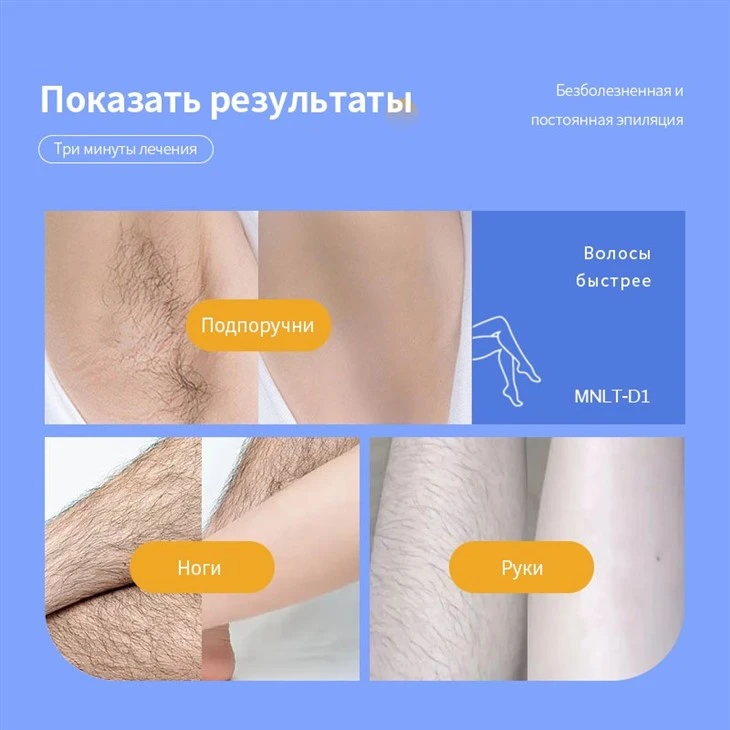 мягкий свет лазерного удаления волос машина